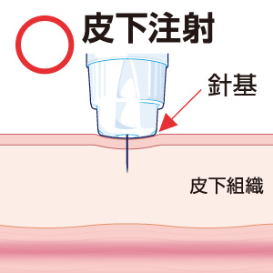 注射針に関する注意点